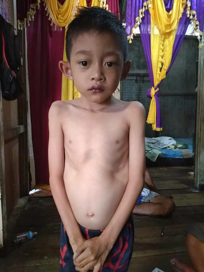 Bocah Menderita Jantung Bocor Butuh Bantuan