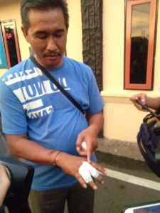 Sebelum Tewas, KC Bacok Korban dengan Celurit