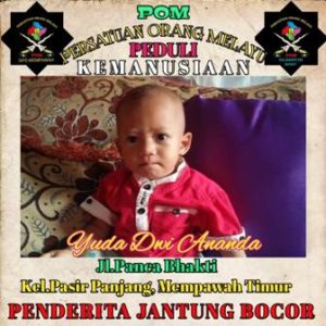 Yuda Dwi Ananda, Bocah Bocor Jantung Perlu Uluran Tangan