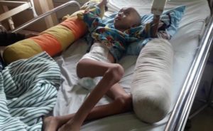 Karena Tumor, Setiap Hari Dian Harus Menahan Sakit di Kepala