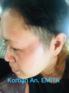 Berawal Saling Maki, Pemuda Ini Emosi Pukuli Pacar