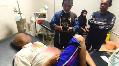 Aksi Keji Pria Bertopeng di Kubu Raya: Pemilik Toko Dibacok Saat Jaga Toko, Pelaku Buron