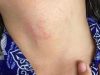 Viral Dugaan Bullying Siswi MI di Kubu Raya Diduga Dicekik Pakai Tali, Jiwo: Tanggung Jawab Sekolah