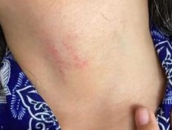 Viral Dugaan Bullying Siswi MI di Kubu Raya Diduga Dicekik Pakai Tali, Jiwo: Tanggung Jawab Sekolah